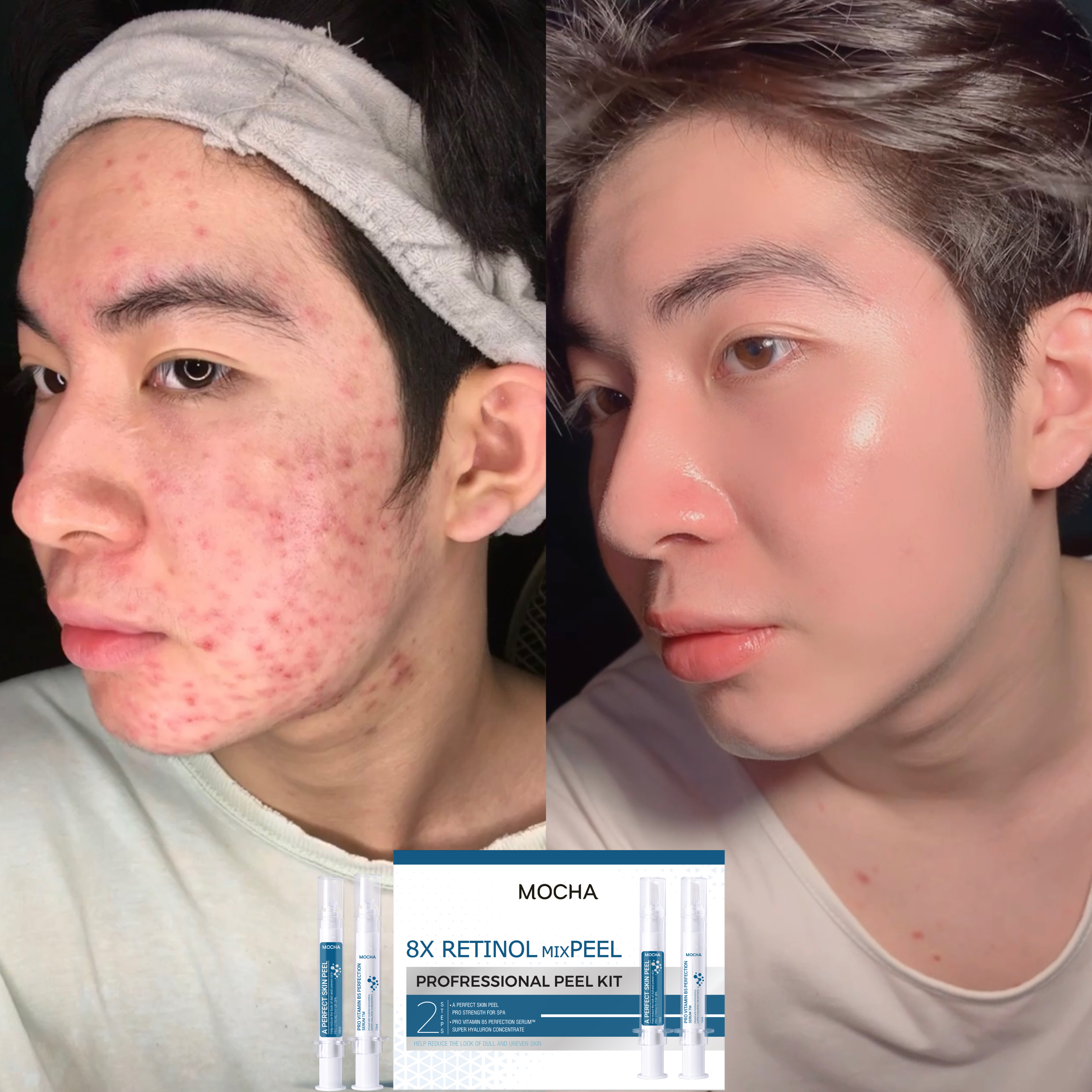 Peel da Mocha Retinol