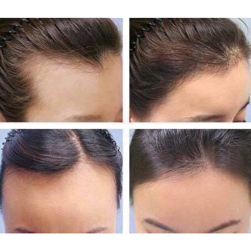 (Hàng Thái Lan Chính Hãng) Tinh dầu bưởi xịt mọc tóc Sun On