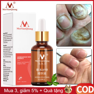 MeiYanQiong Tinh chất thảo dược nấm móng chân tay chống nhiễm trùng - INTL thumbnail