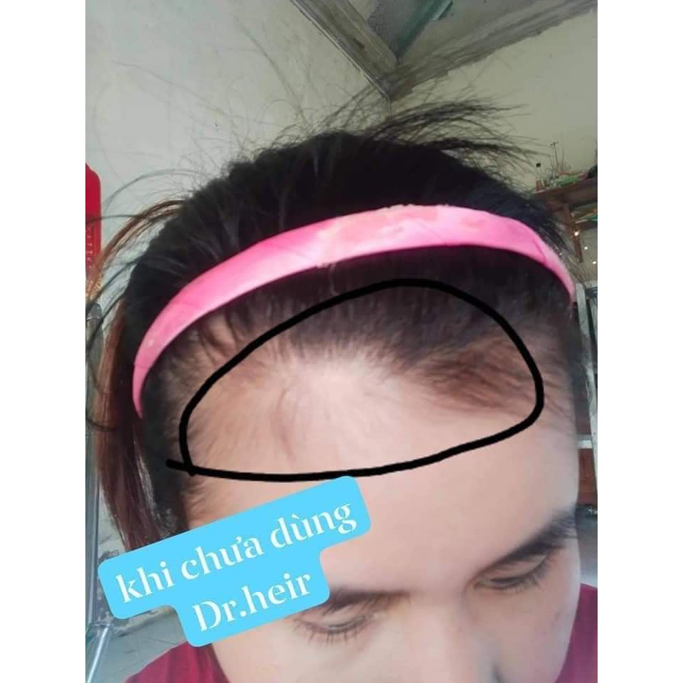 [CHÍNH HÃNG] Tinh Chất Dài Mi Mọc Tóc Dr Hair Zenpali 10ml