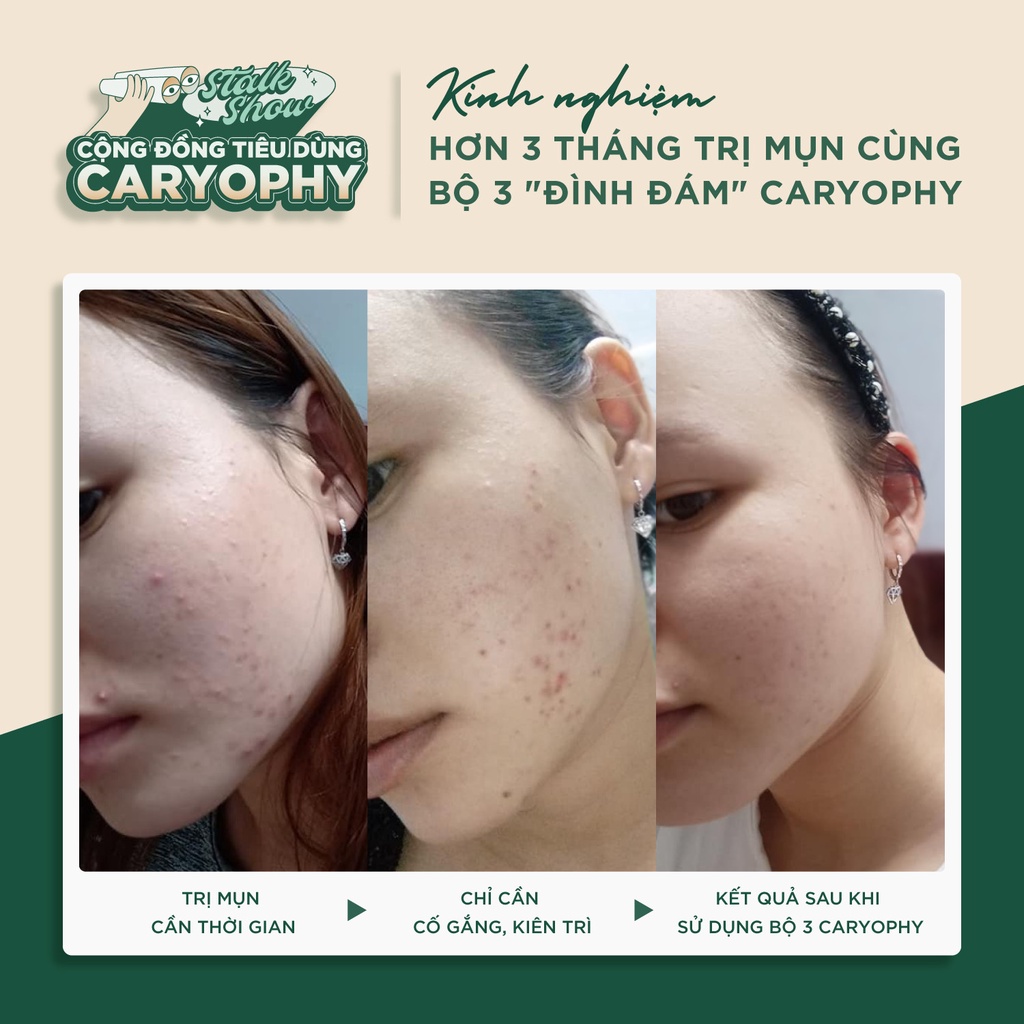 Serum giảm mụn mờ thâm Caryophy Portulaca Ampoule 10ml