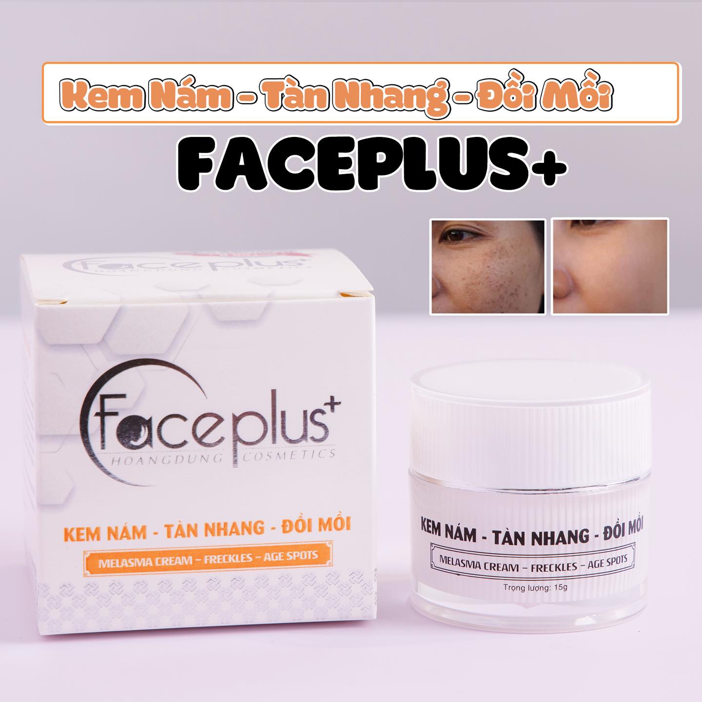 Kem nám tàn nhang đồi mồi Mỹ phẩm Faceplus+ (15g)