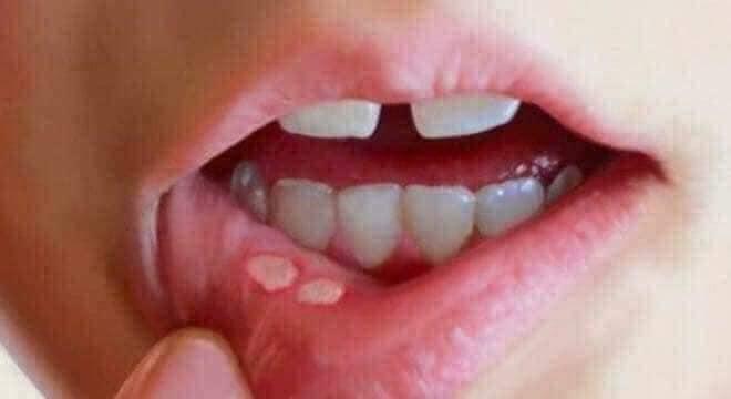NƯỚC SÚC MIỆNG THẢO MỘC HAHA TRẦN MAO