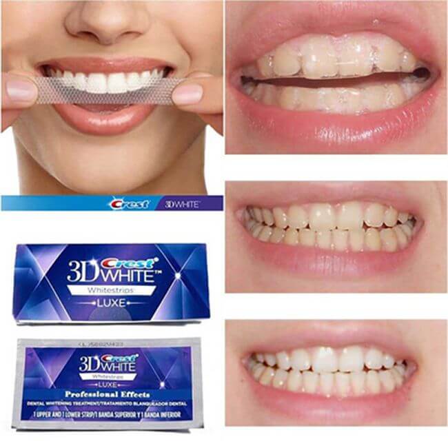 [Combo 4 Gói] Miếng dán trắng răng Crest 3D White (Professional Effects / Glamorous / Gentle Routine)