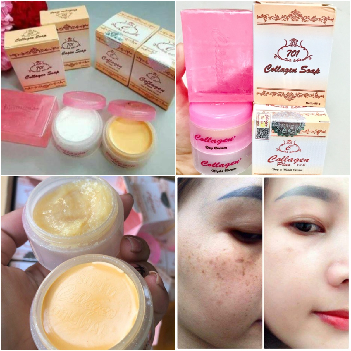 Kem nám tàn nhang cặp Collagen Plus Vit E