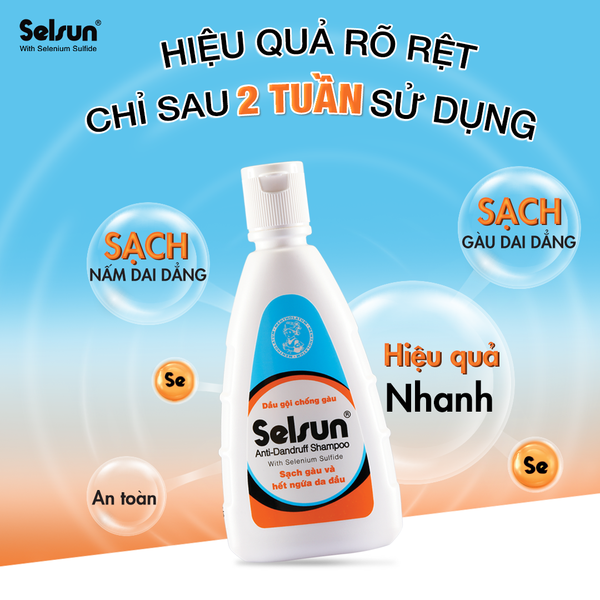 Dầu gội chống gàu Selsun 250ml/ 100ml/ 50ml