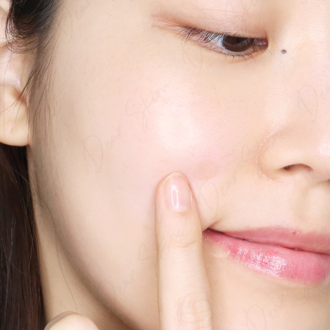 [Chính Hãng] Miếng Dán Mụn COSRX Acne Pimple - Clear Fit  Master Patch - COSRX đỏ - đen