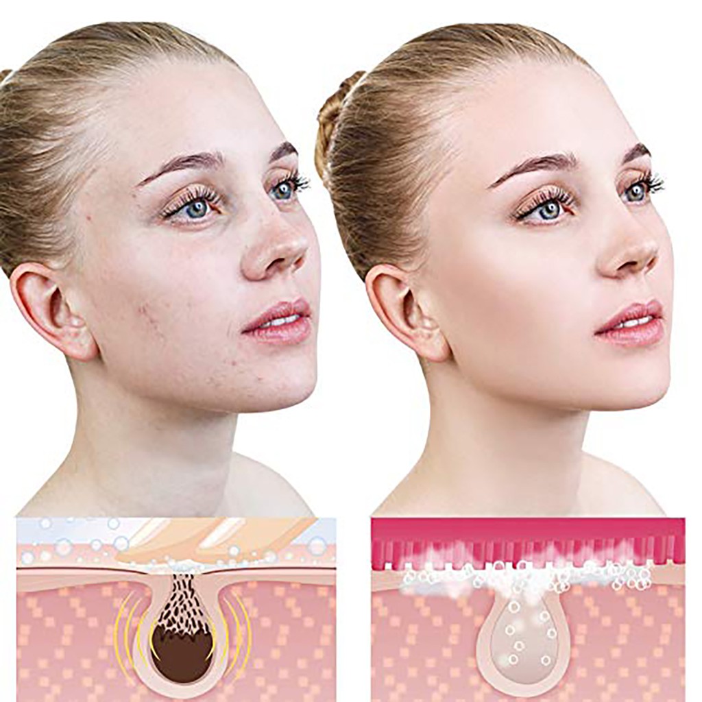 Máy Rửa Mặt Pebble Lisa Phiên Bản 2020 [Chính Hãng]