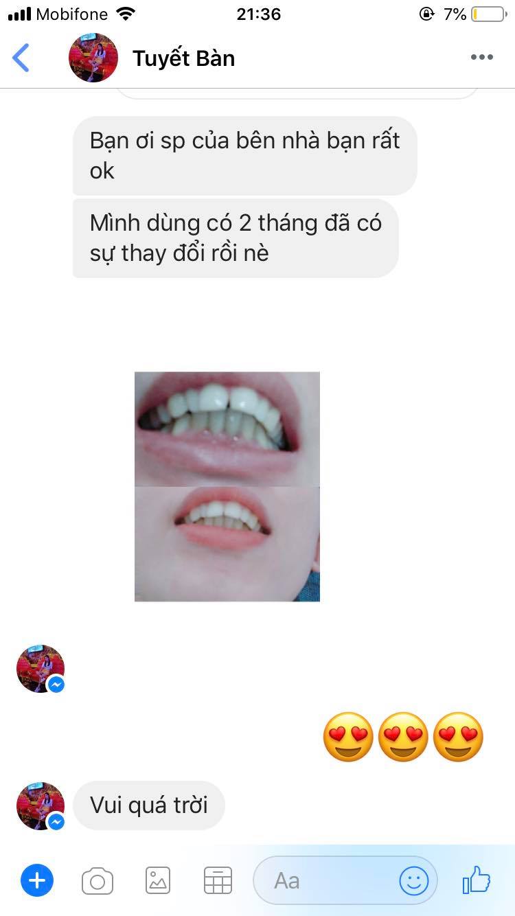 [HCM]DỤNG CỤ NIỀNG RĂNG [[ Dùng cho người lớn ]]( A1 + A2 +A3)