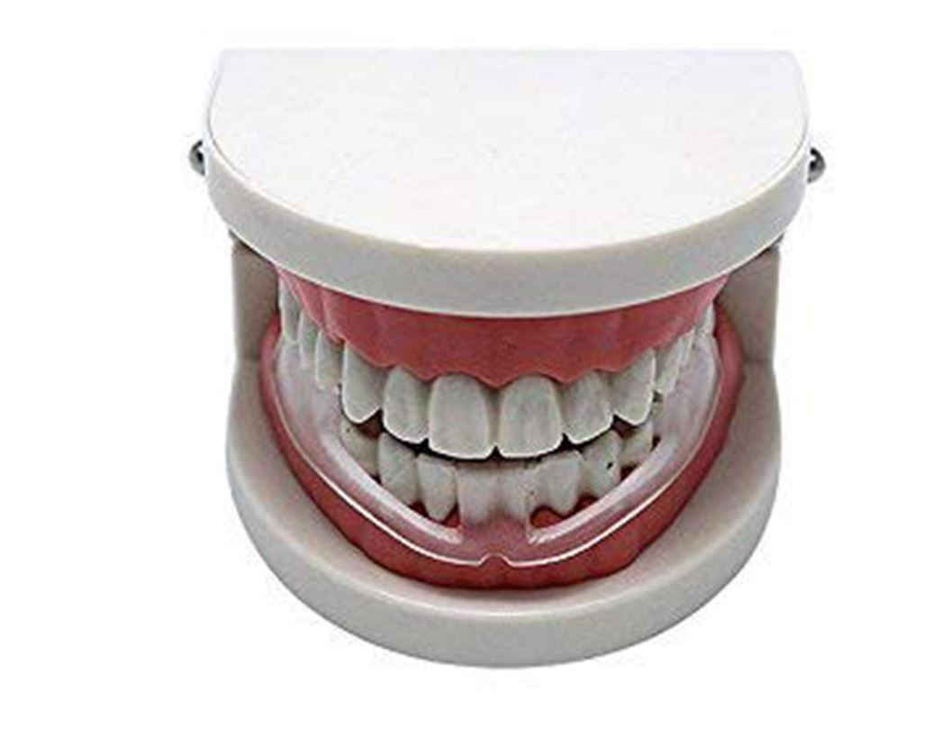 [HCM]DỤNG CỤ CHỐNG NGHIẾN RĂNG - BẢO VỆ RĂNG MIỆNG