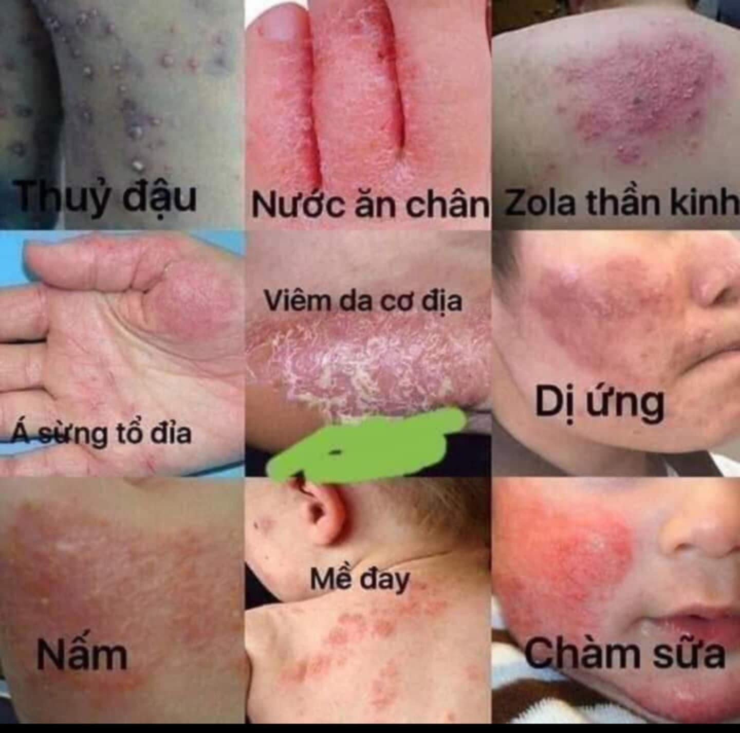 [Mẫu Mới] Kem bôi da Thuần Mộc Thanh Mộc Hương 16g, tặng kèm chai xịt kháng khuẩn
