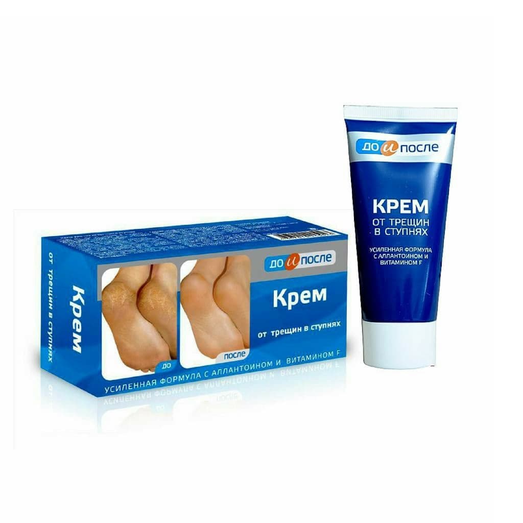 [HCM]Kem Nứt Gót Chân Kpem Nga 50ml