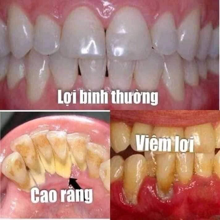 Bột than tre hoạt tính Zenpali