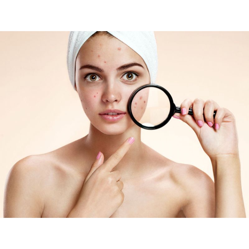 Kem ngăn ngừa mụn(CHÍNH HÃNG)Acne Prevention Dr Cell-sạch mụn mờ thâm 30ml