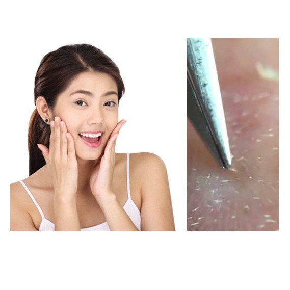 Combo 2 Nhíp gắp mụn chuyên dụng
