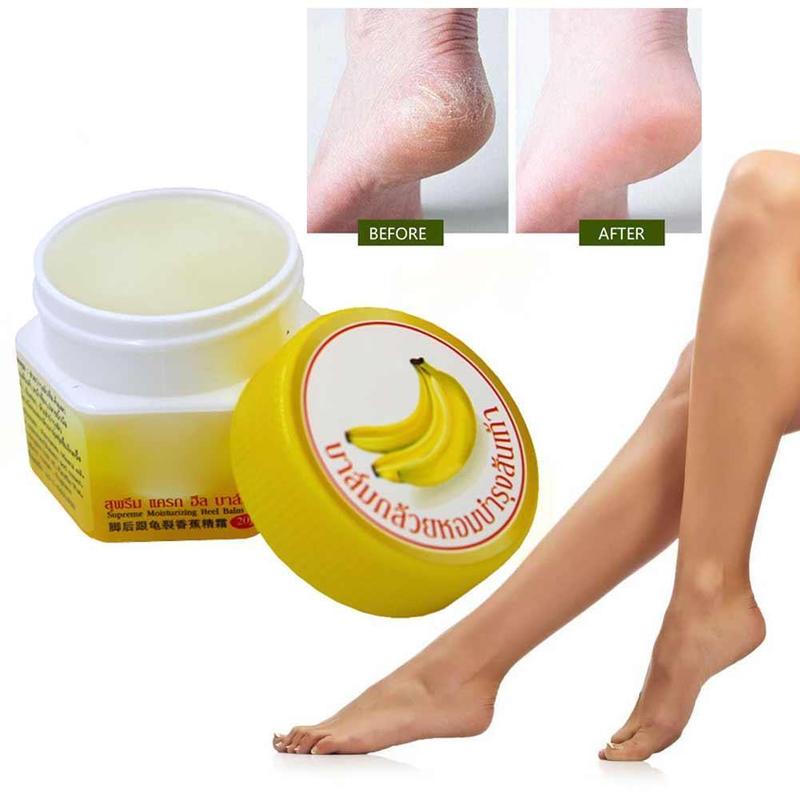 [HCM]KEM CẢI THIỆN NỨT GÓT  CHÂN BANANA