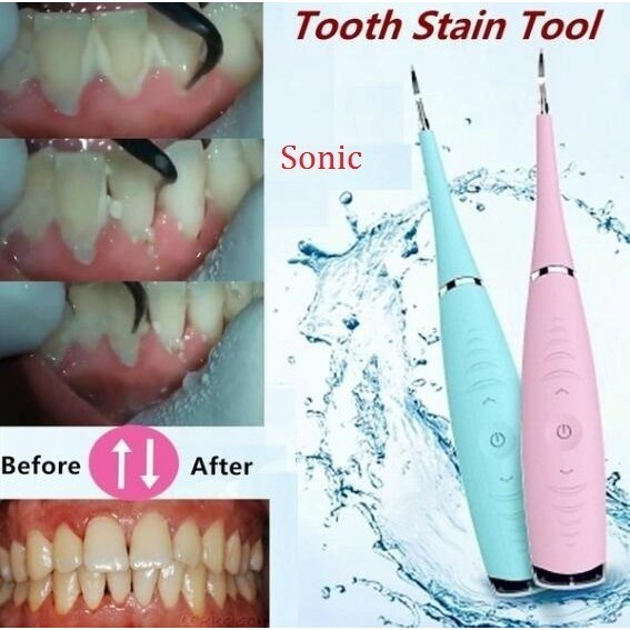 Dụng Cụ Lấy Cao Răng - Máy Lấy Cao Răng Tại Nhà