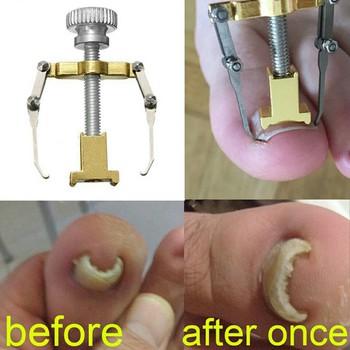 Dụng cụ chữa móng quặp, móng chân chọc thịt đau đớn