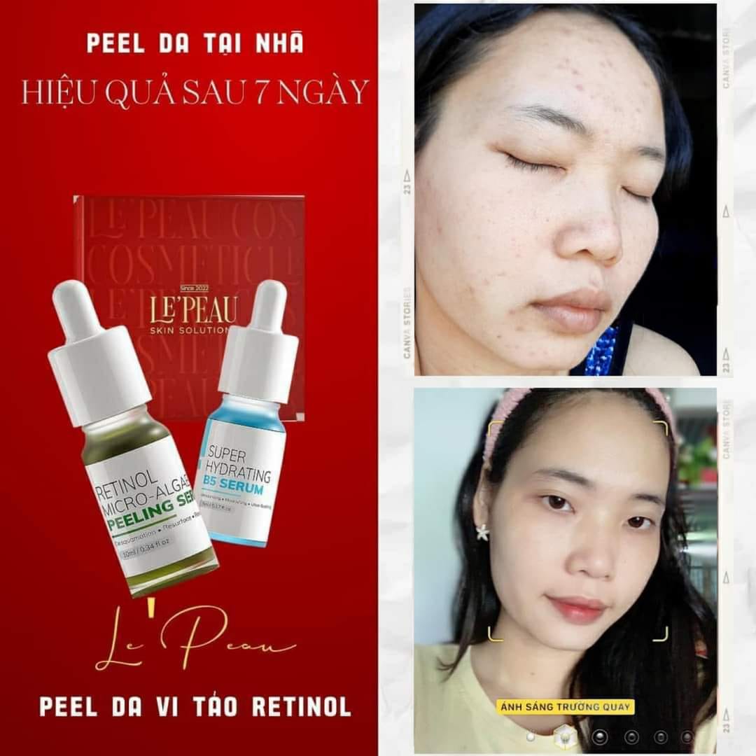 LE’PEAU - Peel da Vi Tảo Retinol [Lepeau tái tạo da sinh học, tặng kèm serum B5 phục hồi da]