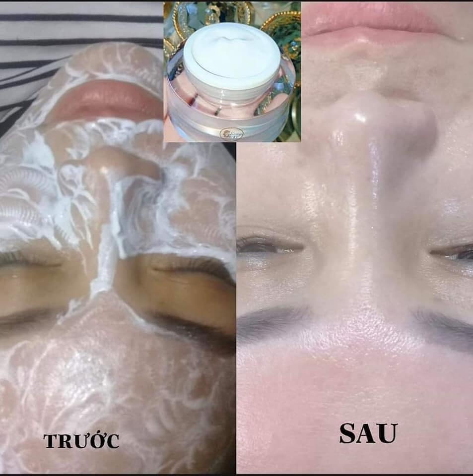 [HCM]COMBO CẤY TRẮNG LỤA NANO + MÁY DI TINH CHẤT CHUẨN SPA TẠI NHÀ [Tặng cọ quét + mặt nạ]