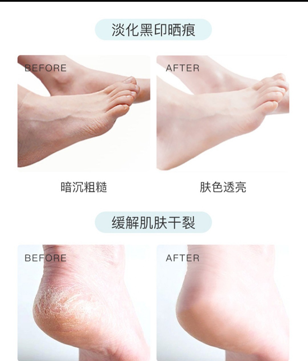 Mặt Nạ Tay Chân  Mèo Ú