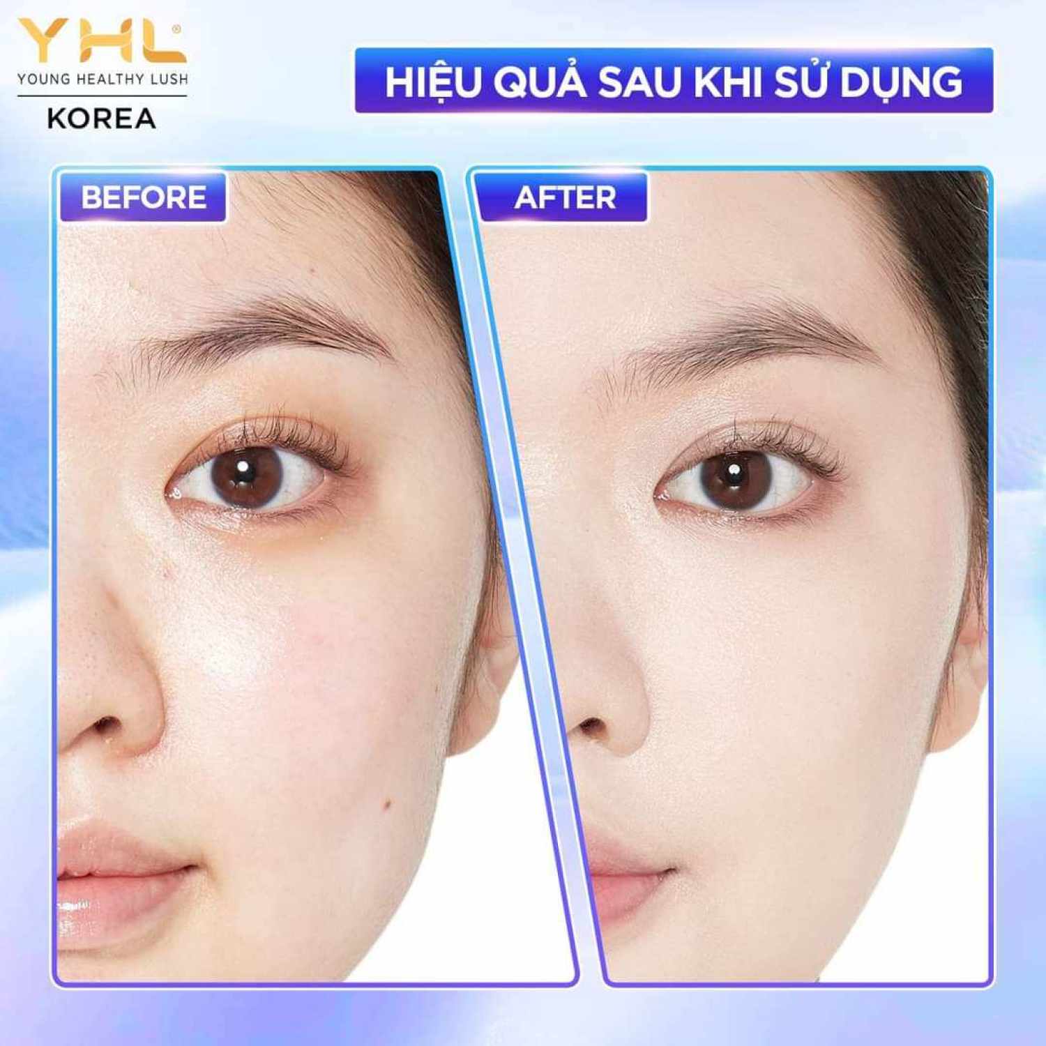 KEM NÂNG CƠ CHỐNG LÃO HÓA YHL[CHÍNH HÃNG SX TẠI HÀN QUỐC]