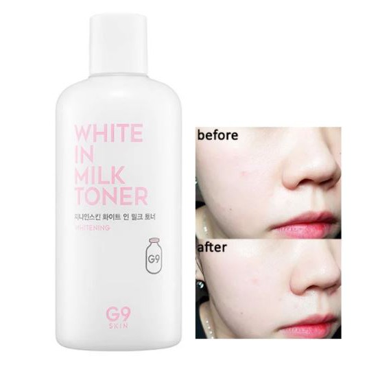 Nước hoa hồng dưỡng trắng da g9skin white in milk toner 300ml