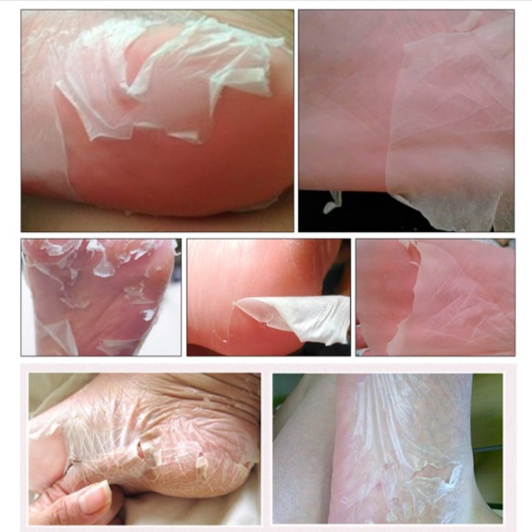 Mặt Nạ Ủ Chân Tẩy Tế Bào Chết