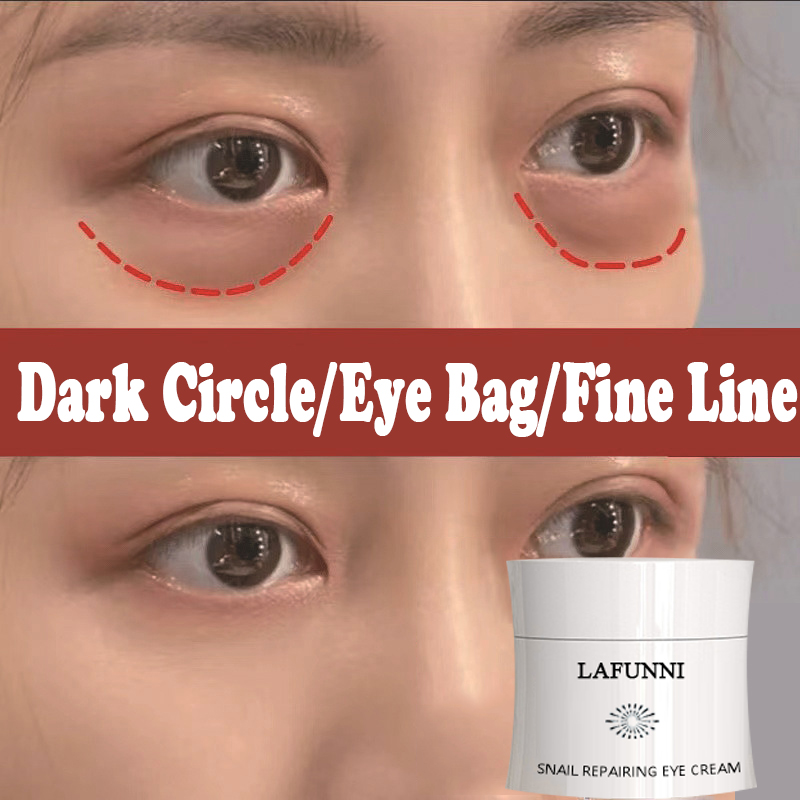 LAFUNNI Snail Eye Cream Anti-Wrinkle Remover Dark Circles Anti-puffiness Bags Nourishing Repairing Eye Cream Care