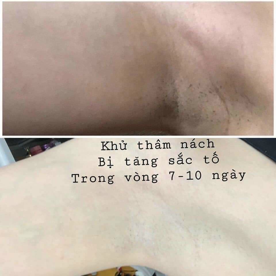 Kem Mờ Thâm Body VIVID WHITE- Nội Địa Hàn Quốc (giảm thâm nách, đầu gối, bikini...)