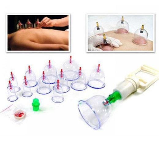 Bộ giác hơi 12 món không dùng lửa