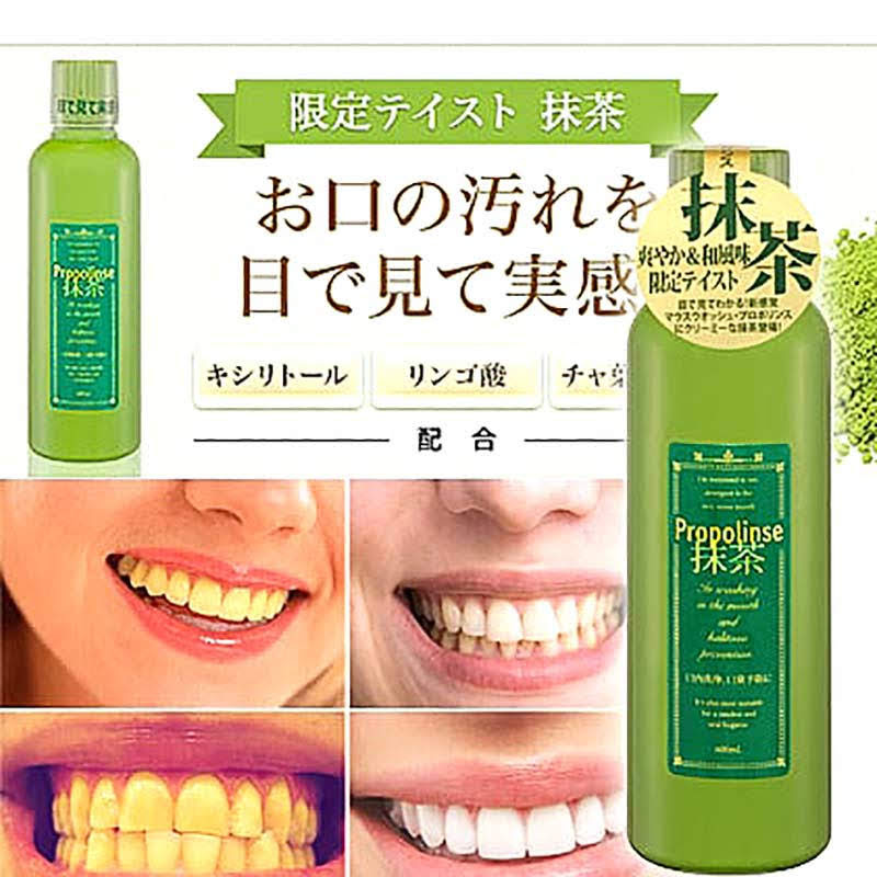 Nước Súc Miệng Propolinse Trà Xanh (600ml)