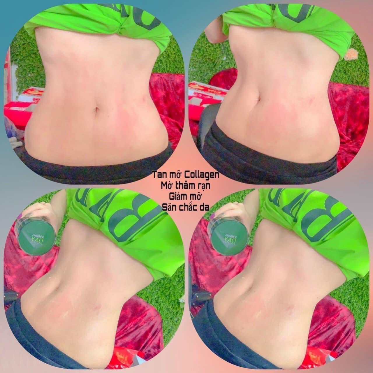 KEM TAN MỠ COLAGEN SLIMMING DAY