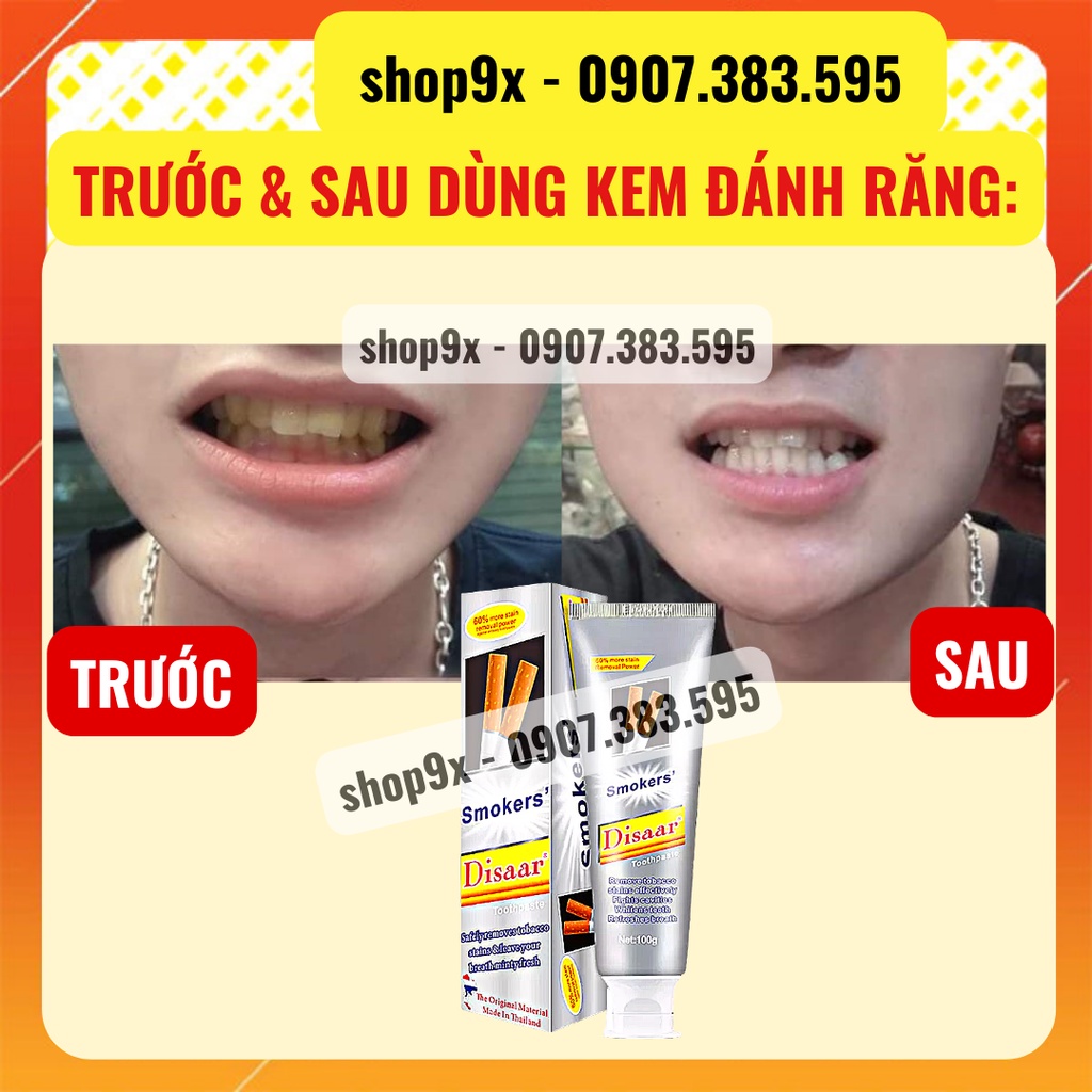 Kem Đánh Răng Cho Người Hút Thuốc Lá Disaar