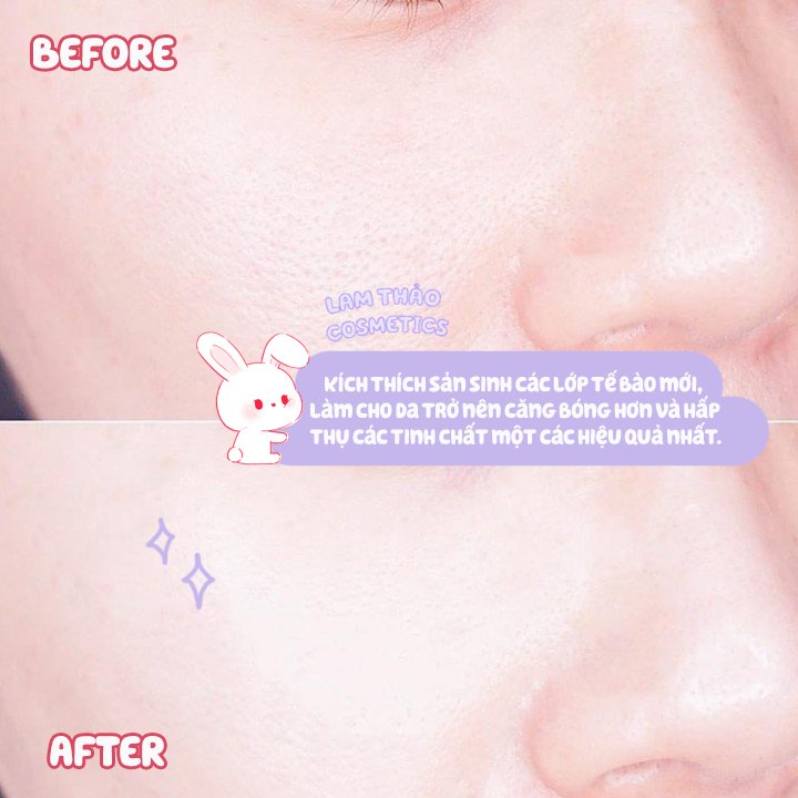 Thay Da Sinh Học SoNatural Red Peel Tingle Serum