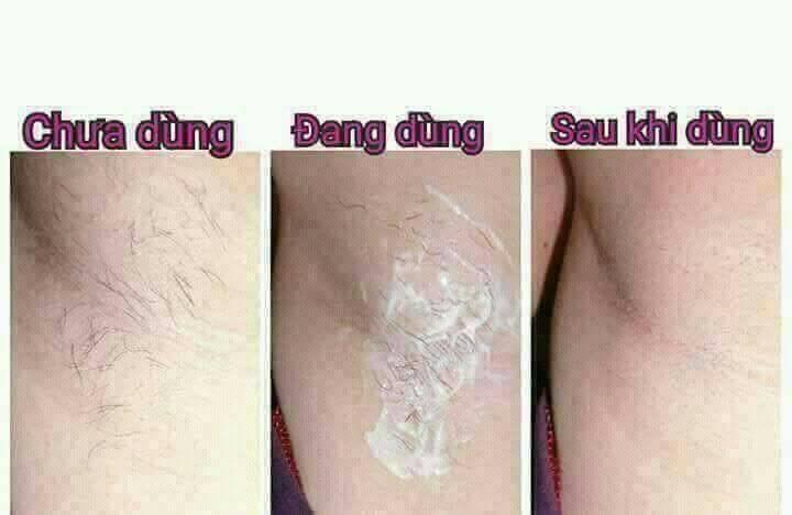 Kem tẩy lông chery Mwhite