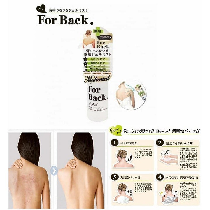 Xịt  Forback 100ml Japan giảm mụn dưỡng da vùng lưng