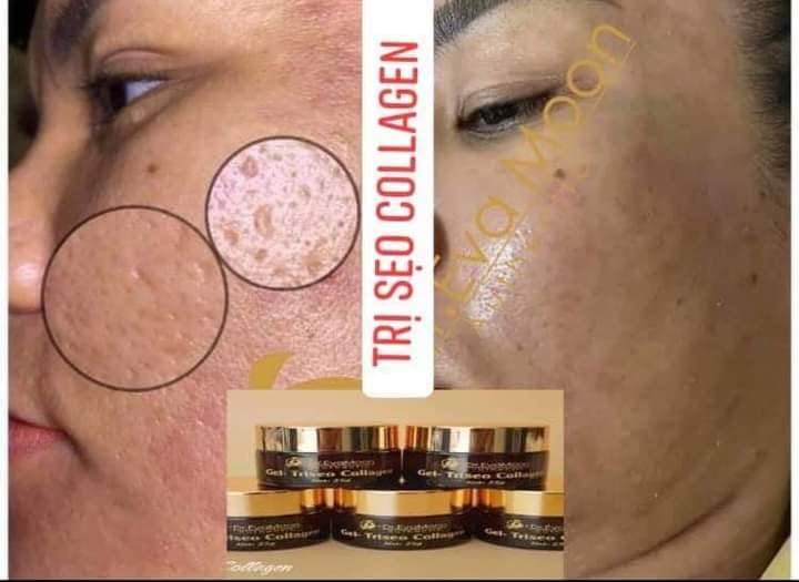Cao sẹo collagen Dr Eva Chính Hãng