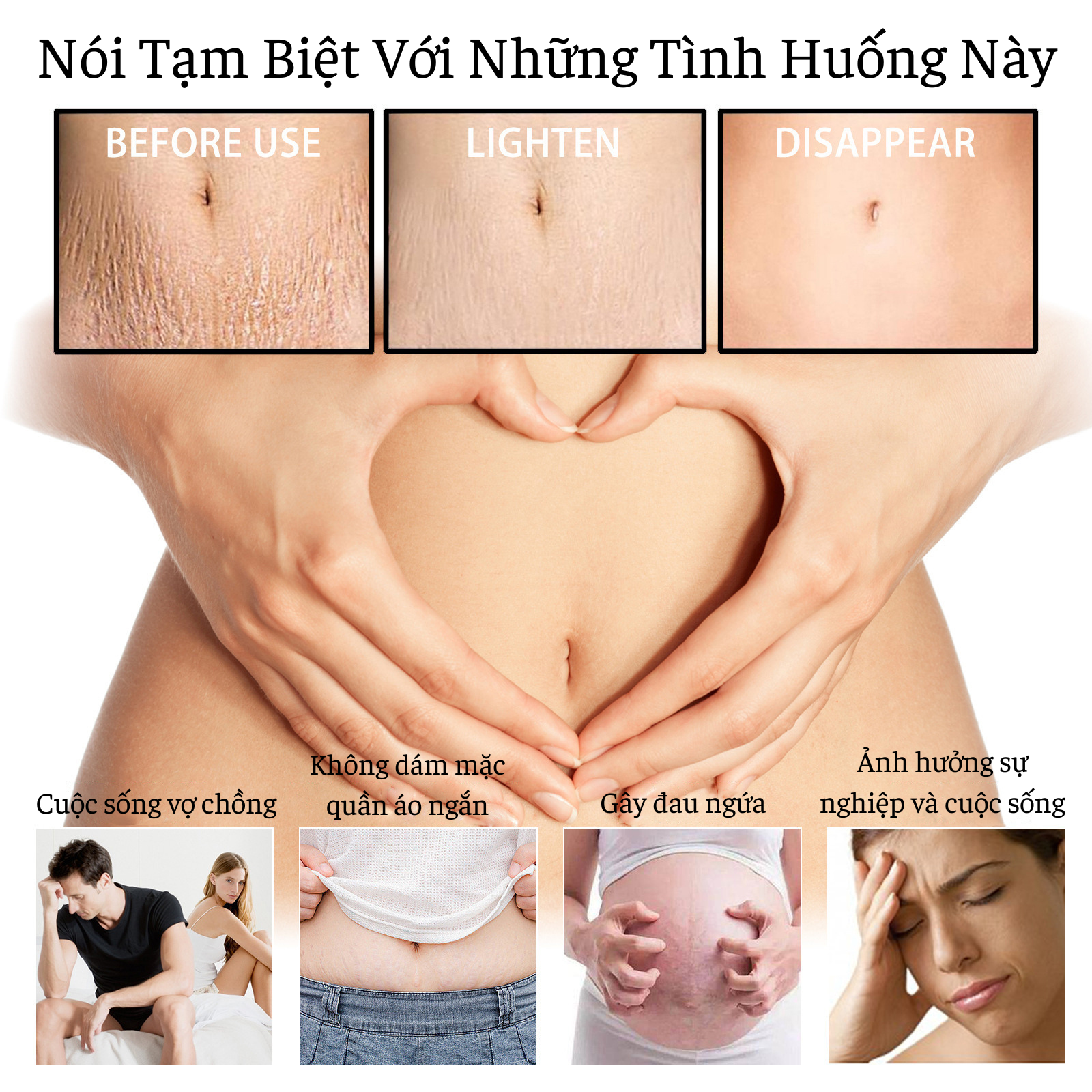 Kem Trị Rạn Da Sau Sinh Cho Bà Bầu Wiieey Cải Thiện Nếp Nhăn, Phục Hồi Độ Đàn Hồi Cho Da, Giữ Làn Da Mịn Màng Tươi Trẻ