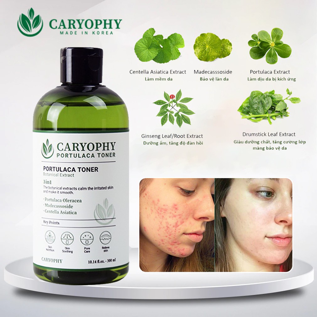 [Chiết - Gốc] Toner CARYOPHY Portulaca dành cho da mụn