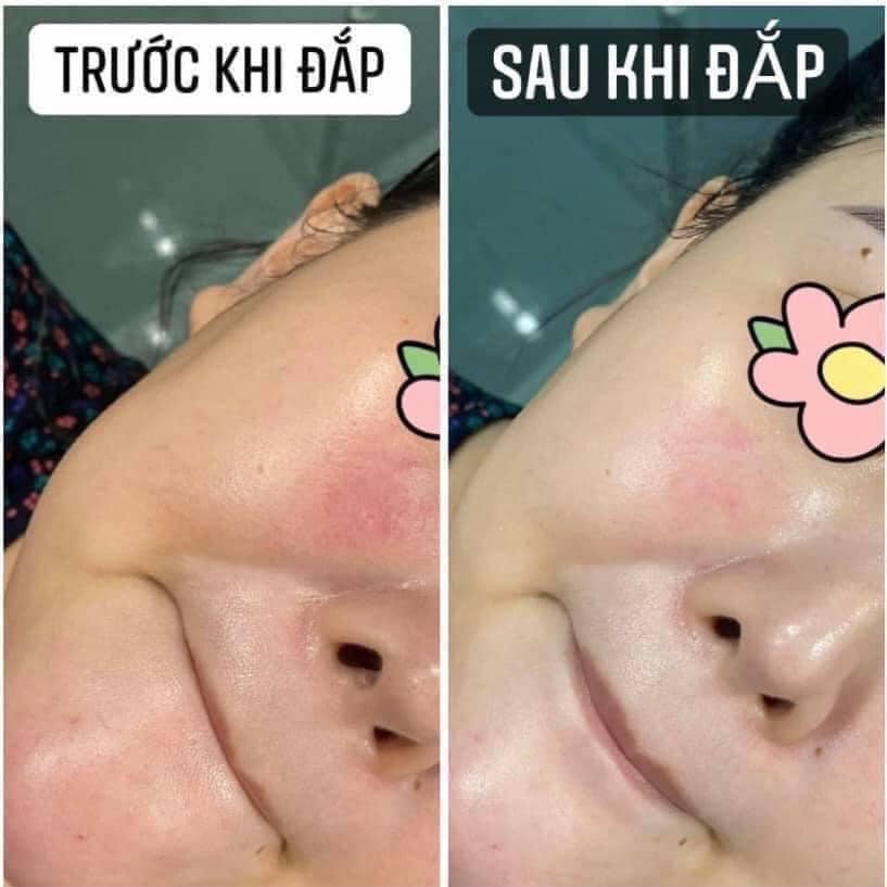Mặt Nạ Smas Peptide Silk Mask Cấp Ẩm, Phục Hồi Da