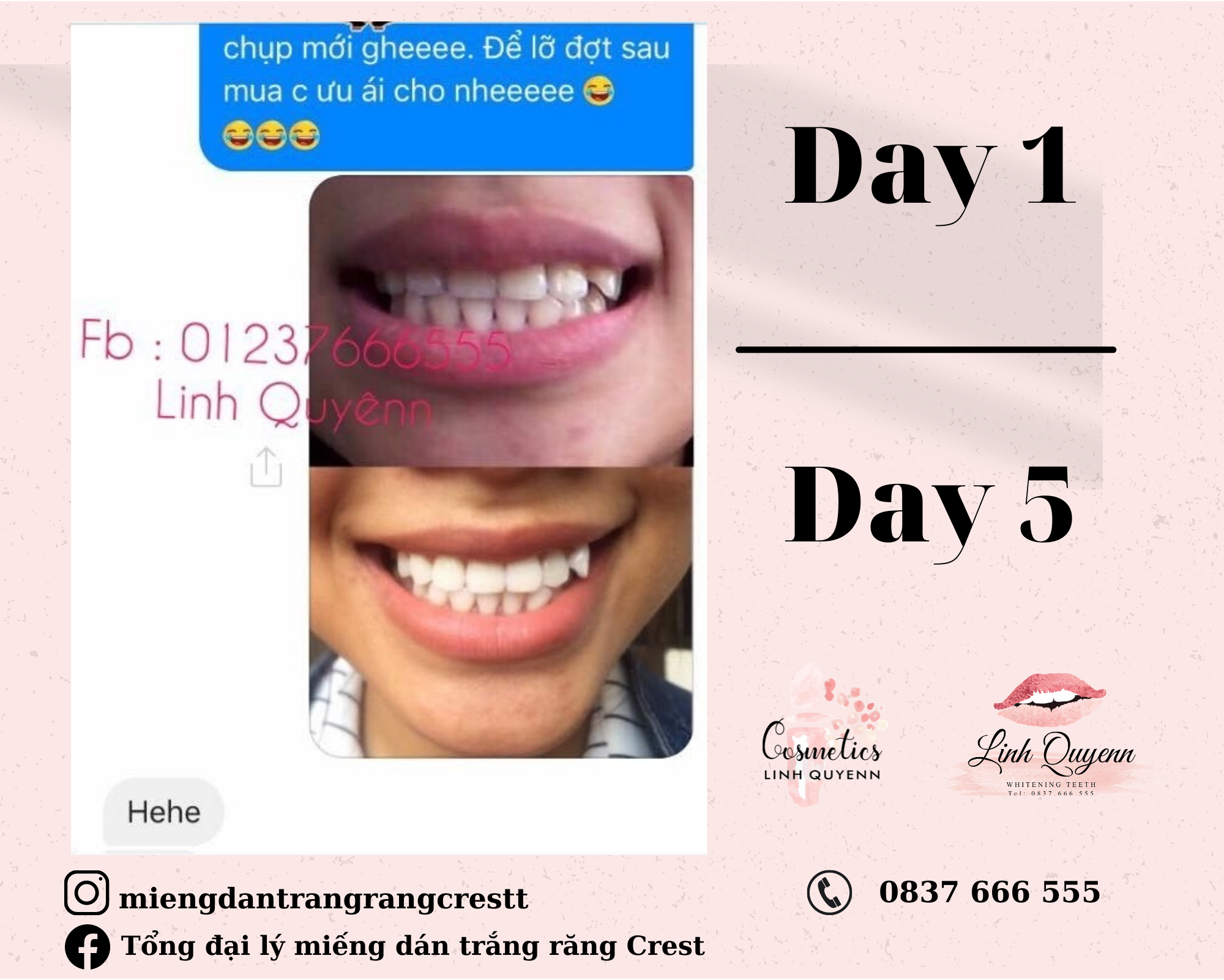 Kem đánh răng Crest Gum Detoxify Siêu trắng 147G