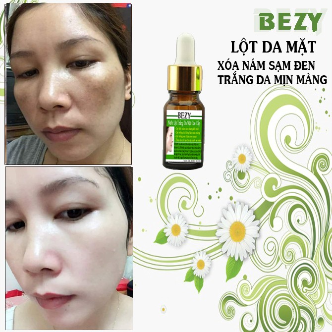 BEZY Lột Thay Trắng Da Mờ Thâm Nám Thái Lan