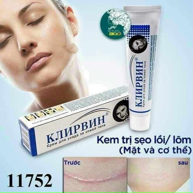 Kem Mờ Sẹo Nga Klirvin 25g