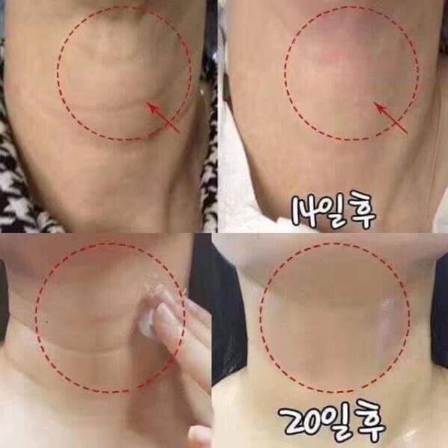 KEM DƯỠNG DÀNH CHO CỔ MEDI PEEL - NECK CREAM