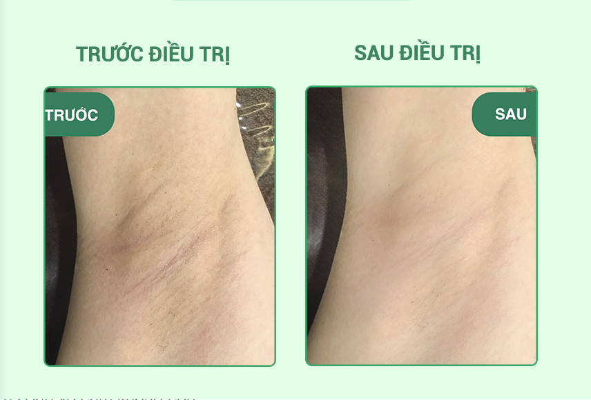 Lăn Nách Angel's Liquid Glutathione Plus Niacinamide Fresh Deodorant 60ml