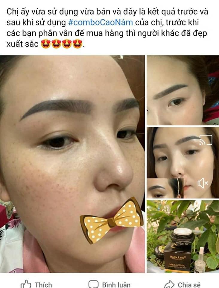 [HCM]CAO NÁM BALLA LUTA -  MỜ NÁM SẠM DA