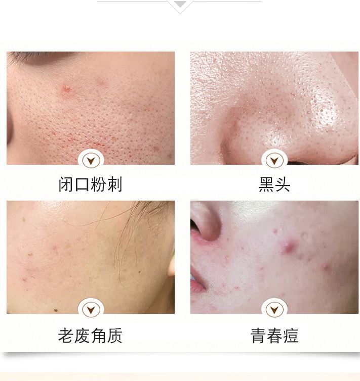 Serum tinh chất trắng da dưỡng căng bóng SEOMOU 30ml chiết xuất hoa phong lan thành phần tự nhiên A44