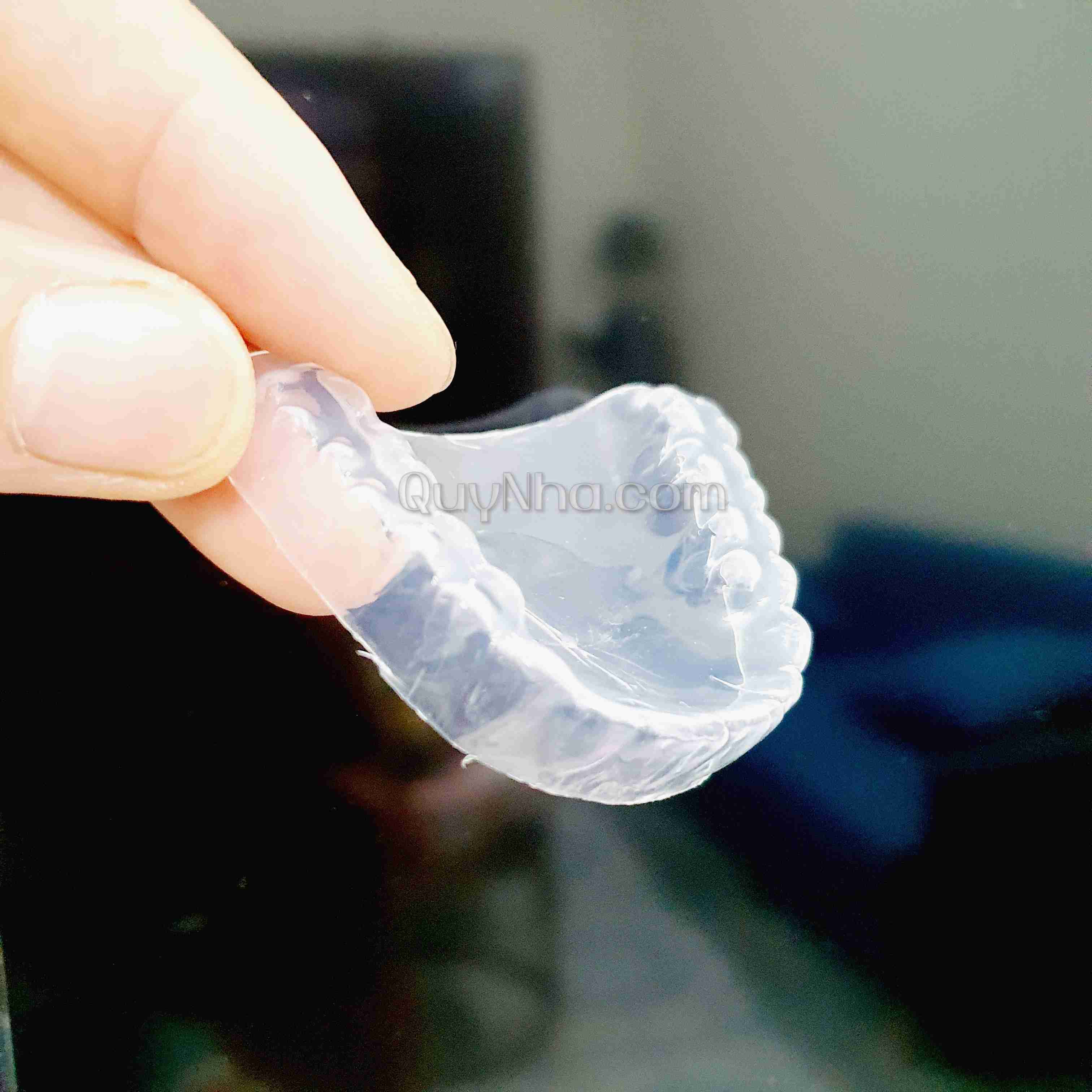 Máng tẩy trắng răng tại nhà