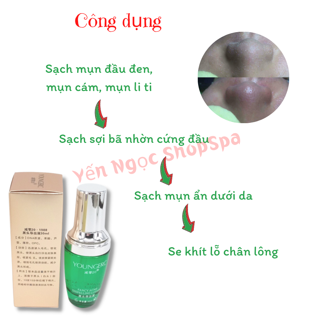 Ủ mụn Youngerc, ủ mụn đầu đen, mụn cám dùng cho cá nhân và spa